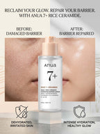 Anua 7 Rice Ceramide Hydrating Barrier Serum - 50Ml