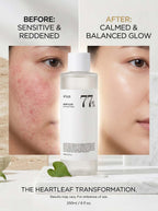 Anua Heartleaf 77% Soothing Toner 250Ml