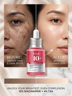 Anua Niacinamide 10% + TXA 4% Serum – Brightening & Dark Spot Care | Original Korean Skincare Pakistan