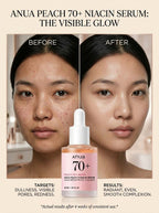 Anua Peach 70 Niacin Serum/30ml