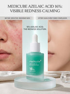 Medicube - Azelaic Acid 16 BB Calming Serum - 30ml